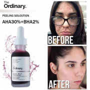 The Ordinary-AHA 30% + BHA 2% Peeling moo 果酸煥膚精華30ml (現貨)